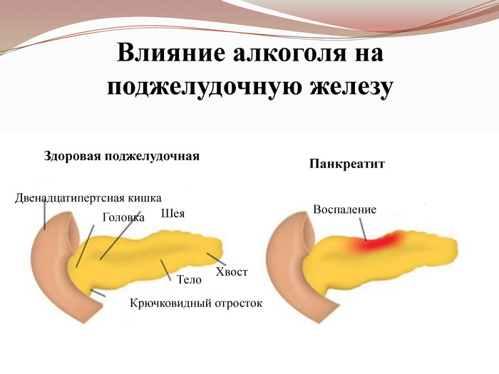 Алкоголь и поджелудочная