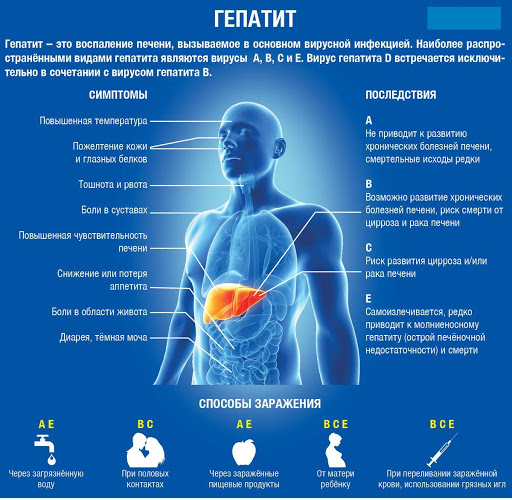 Геппатиты. А Б С D и их симптомы